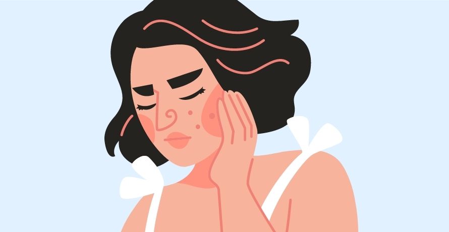 Hormonelle Akne - Tipps