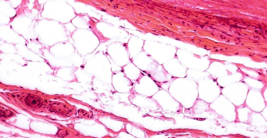 Kollagen gegen Falten 