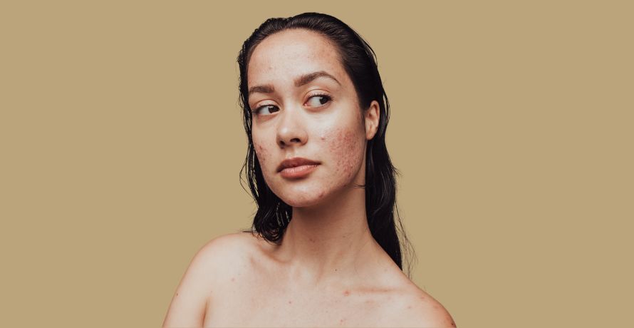 Komedogene Inhaltsstoffe