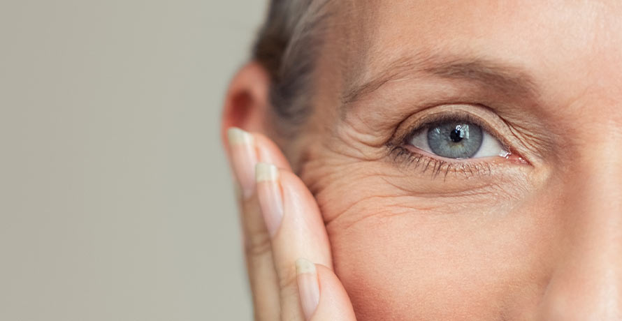 Unsere Tipps bei Krähenfüße