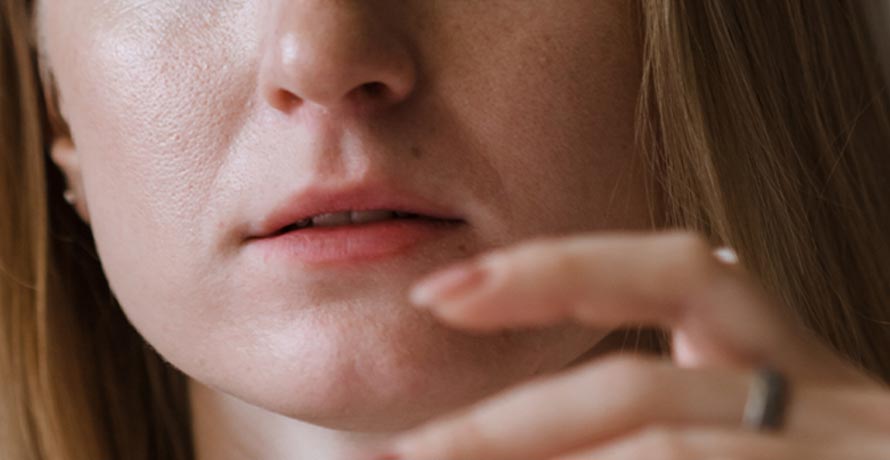 Periorale Dermatitis Tipps