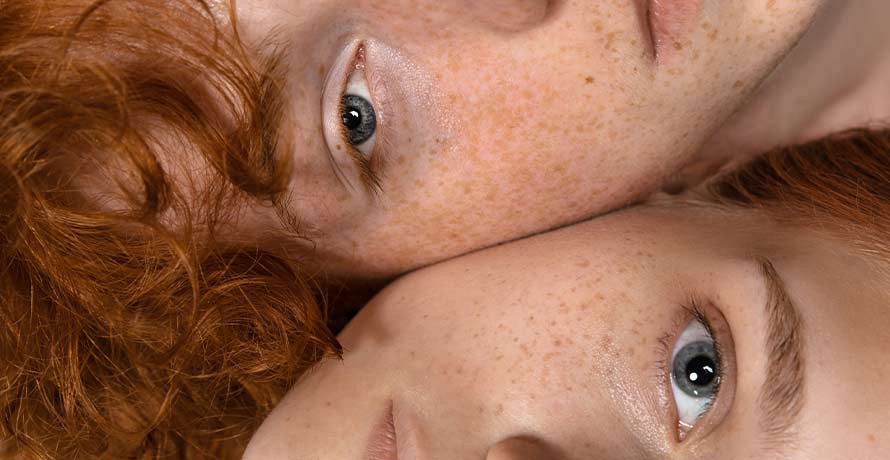 Pigmentstörung und Hyperpigmentierung