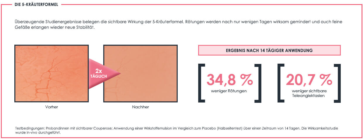 Studien belegen sichtbare Ergebnisse der Gesichtspflege bei Couperose