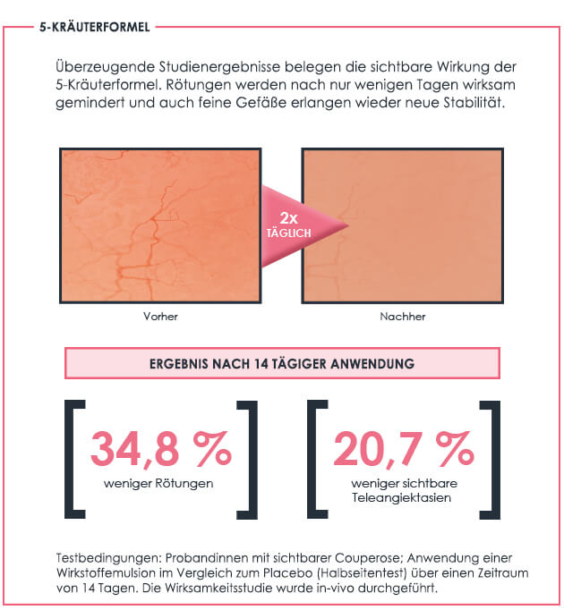Studien belegen sichtbare Ergebnisse der Gesichtspflege bei Couperose