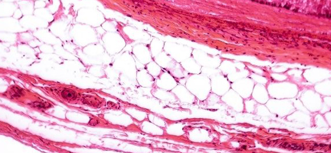 Kollagen gegen Falten