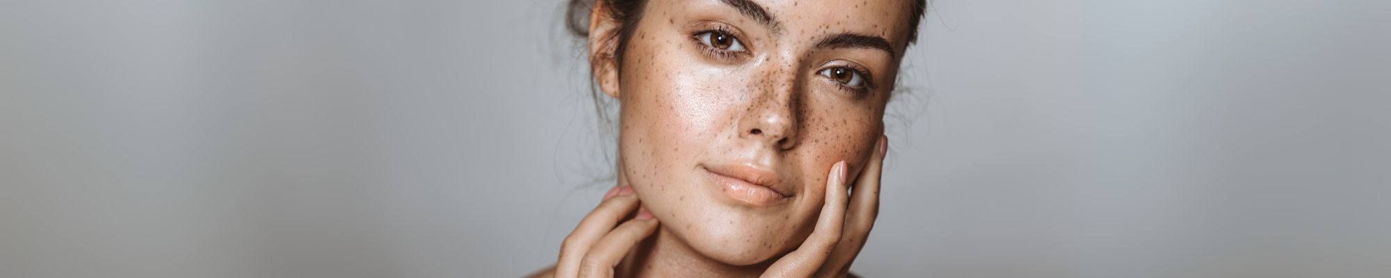 So Pigmentflecken, Altersflecken, Hyperpigmentierung und Pickelmale entfernen