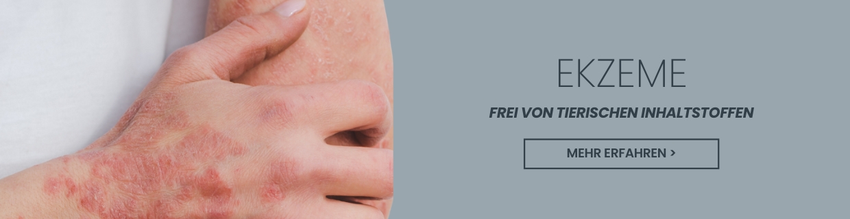 Ekzeme gehÃ¶ren zu den hÃ¤ufigsten Hauterkrankungen
