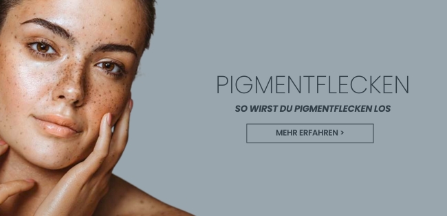  Hyperpigmentierung endlich loswerden! Cremes gegen Altersflecken 