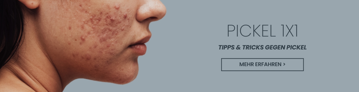 Was hilft gegen Pickel